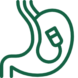 Upper GI endoscopy​ procedure
